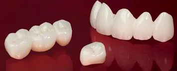Zirconia crowns and bridges