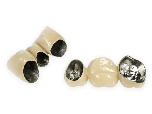 Metal-ceramic crowns