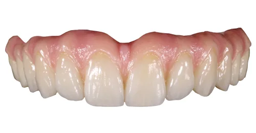 Prettau anterior